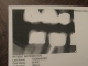 this is how the dentist sees me